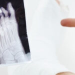 Close-up of a dancer's foot showing the intricate bone structure and ligaments
