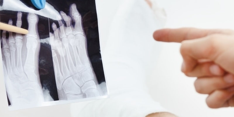 Close-up of a dancer's foot showing the intricate bone structure and ligaments